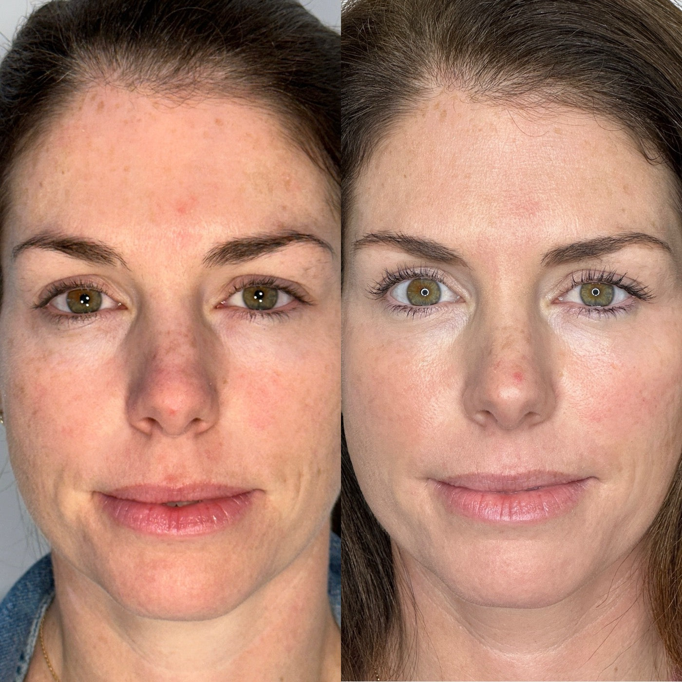 Peptide Potion early tester, before and after