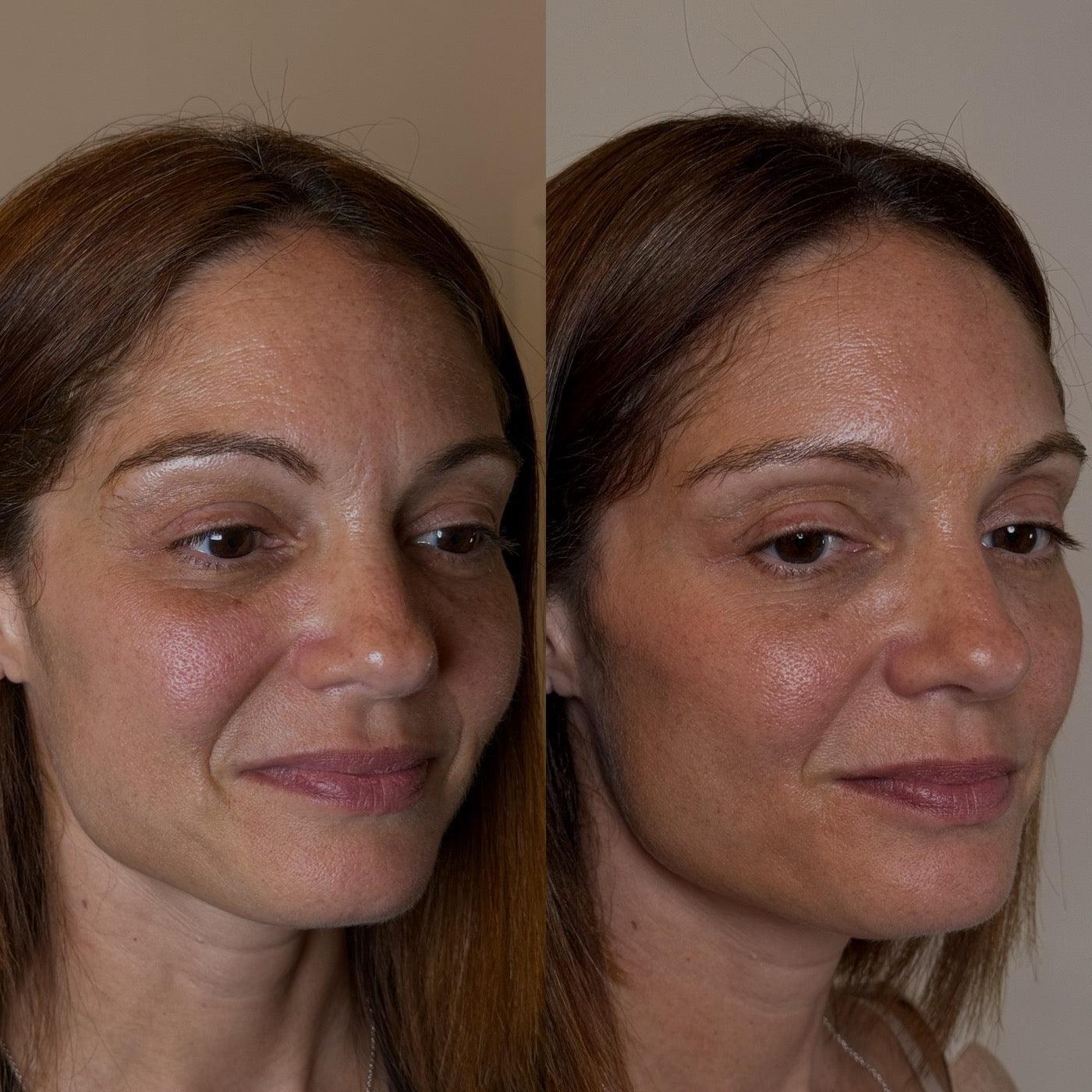 Peptide Potion early tester, before and after