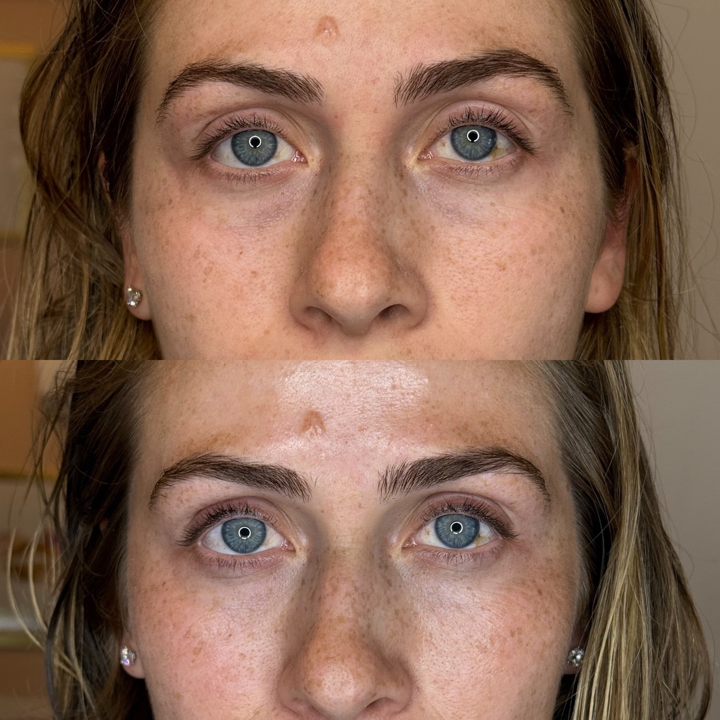 Peptide Potion early tester, before and after